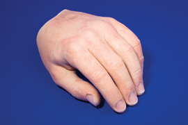 Hand